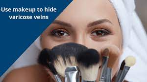 learn how to hide varicose veins usa