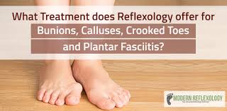 Reflexology Treatments For Bunions Calluses Crooked Toes