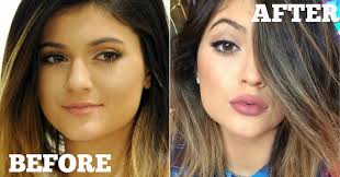 plump and fuller lips naturally