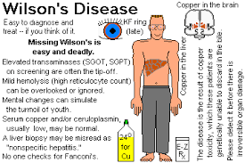 Liver And Biliary Disease Wilsons Disease Disease