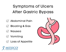 ulcers after gastric byp