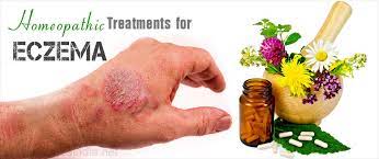 Farmers, those with animal stock, and pet breeders have used it for many decades, but the pharmaceutical and medical industries prefer that people do not know. Eczema Miracles With Homeopathy