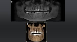 dental technology healthy roots dentistry