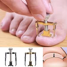 ingrown toenail treatment kit