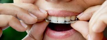 The question is, how long do you need to wear it? How Long Do You Have To Wear Retainers After Braces