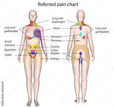 organ referred pain chart stock