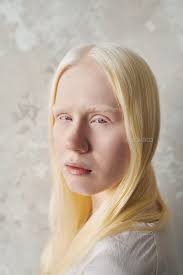 beautiful albino woman with no makeup
