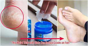 8 surprising uses of vicks vaporub you