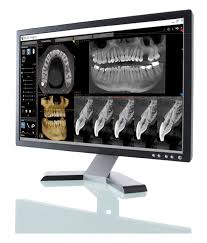 technology nerness endodontics