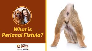 dr becker what is peri fistula