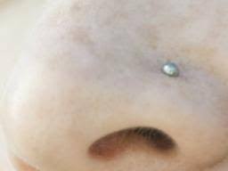 An austin bar piercing is performed horizontally through the tip of the nose. Nose Piercing Bump Causes And Home Remedies