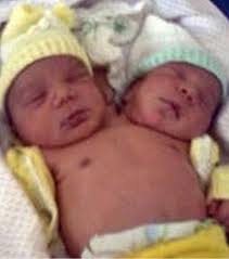 They are dicephalic parapagus twins, and are highly symmetric for conjoined twins. Wetten Das Wusstet Ihr Noch Nicht Uber Abby Und Brittany Hensel