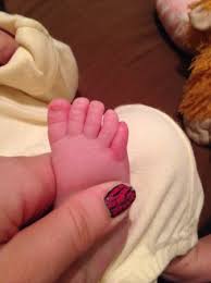 (chase looks so guilty in the above pic! Red Pinky Toe Pic Babycenter