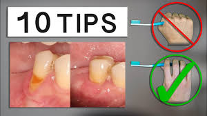 10 tips to minimize gum recession at