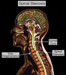 what is causing my arm numbness