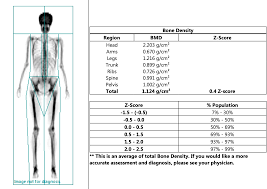 my experience with a dexa scan what is