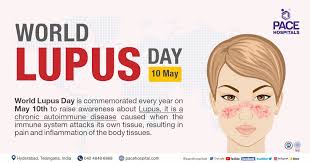 world lupus day 10 may 2023 theme