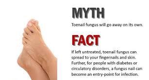 toe and finger nail fungal infections