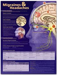 Migraines And Headaches Anatomical Chart