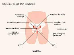 pain in pelvis 24 causes in men and