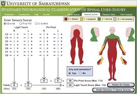 Free interactive exercises to practice online or download as pdf to print. A Web Based Computer Program To Determine The Asia Impairment Classification Spinal Cord
