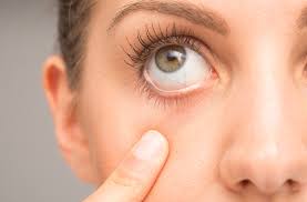 how omega 3 s can help treat dry eye