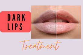 dark lips skin smile clinic