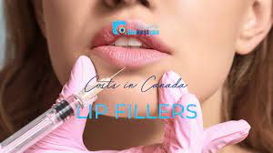 how much do lip fillers cost the