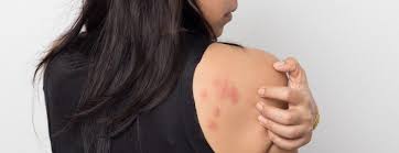 skin rashes conditions types when