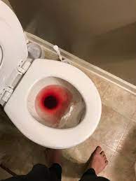 I never mentioned that i had been bleeding everytime i went to the bathroom for over a year. See Comments For Details But Looking For Advice Opinions Coloncancer