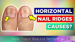 horizontal ridges on nails cause