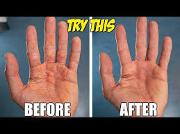 how to get rid of hand calluses and