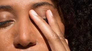 eyelid eczema treatment causes and