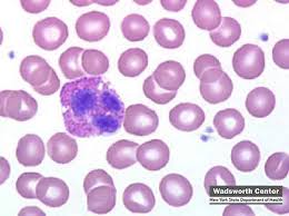 Image result for leukocytes