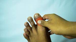 7 common causes of big toe pain