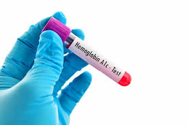 hba1c test normal prediabetes
