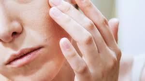 eczema dermatologists on how to
