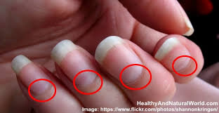 black spot around your toenail cuticle