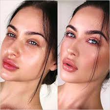 using lip balm after lip fillers tips