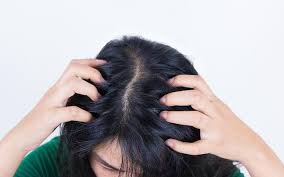 This is perhaps one of the oldest remedies for dry hair. Dry Scalp Treatments Home Remedies Oils Diet More Skinkraft