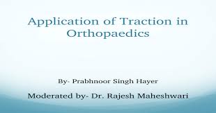 The patient's body should always be in alignment with the force of traction. Application Of Traction In Orthopaedics Ppt Powerpoint