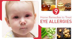 9 simple home remes for eye allergies