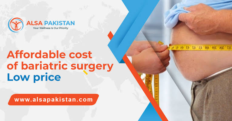 Affordable cost of bariatric surgery | Low price