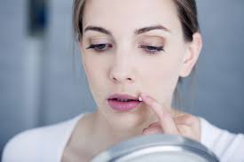 cheilitis lip inflammation causes