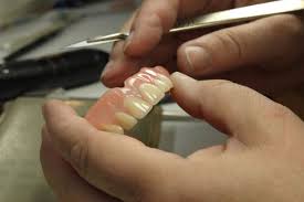 my dentures during denture repair