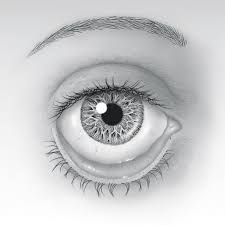 Eyelid flip / ectropion causes symptoms and complications. Ectropion