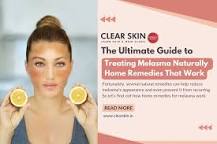 The Ultimate Guide to Treating Melasma Naturally: Home ...