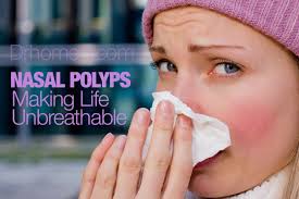 7 best homeopathic cines for nasal