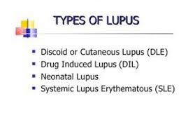 diffe types of lupus lupus911