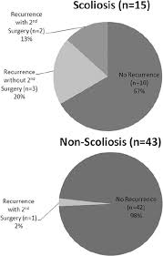 Scoliosis May Increase The Risk Of Recurrence Of Lumbar Disc